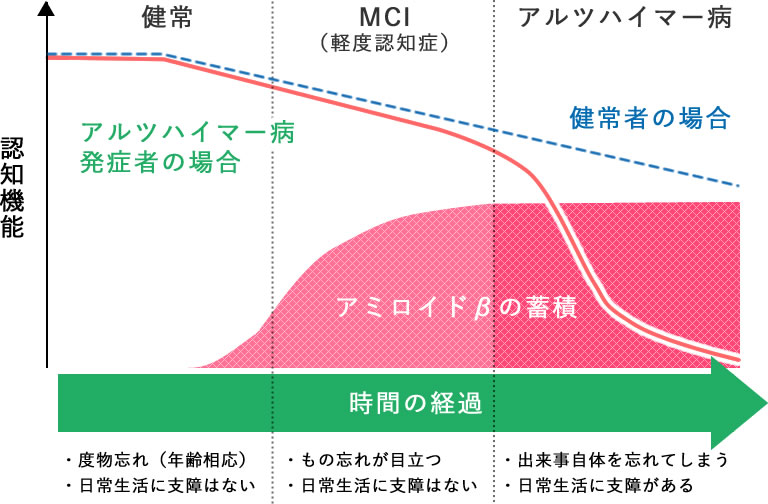 MCI