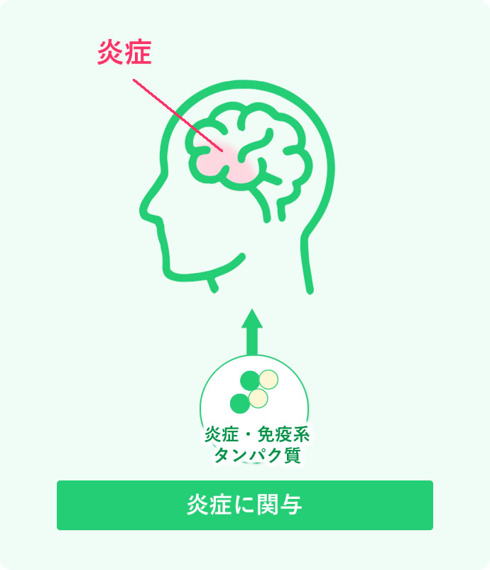 MCI
